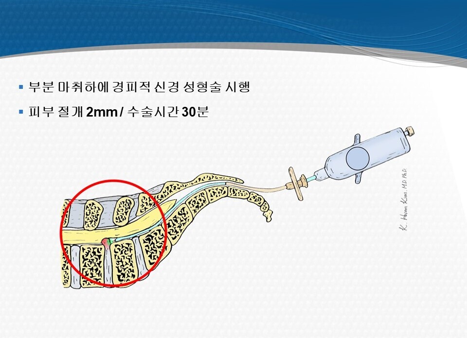 질환·치료정보 관련 공개 이미지