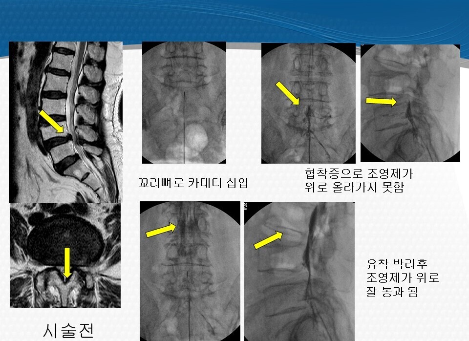 질환·치료정보 관련 공개 이미지